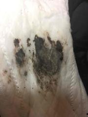 引产可以吃纟瓜吗,纟瓜的适宜与否探讨