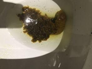 吃瓜大便不成型